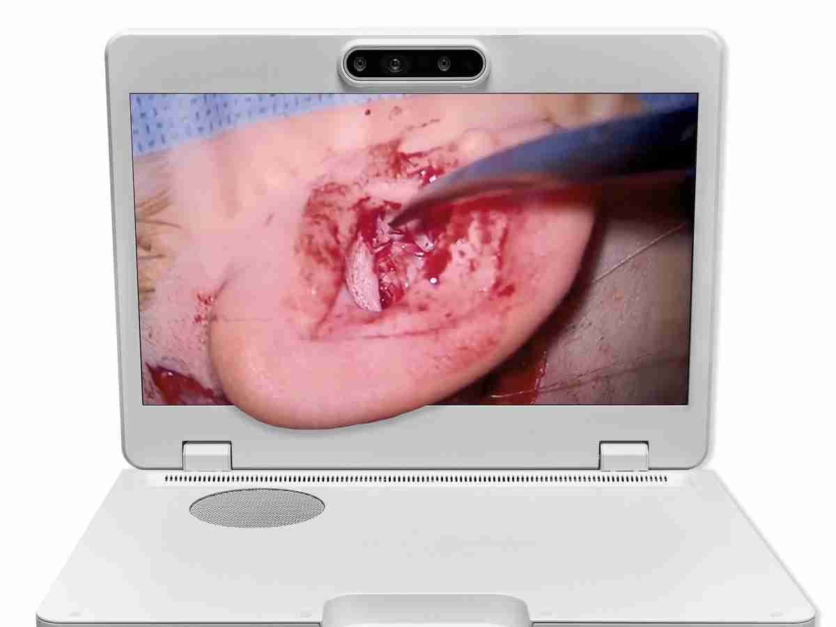 达擎之＂Heads-up 3D显微手术显示系统＂，，，整合4K裸眼3D显示及眼球追踪系统，，，具备快速追踪人眼移动位置功能，，减轻医师长时间维持固定姿势的负担，，，，让医师能有更宽广清晰的3D立体视野及更舒适的姿势来执行手术。。